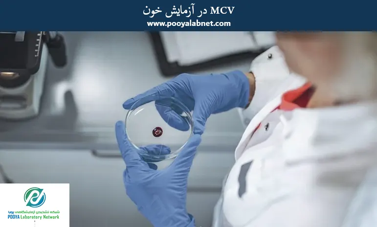 MCV در آزمایش خون
