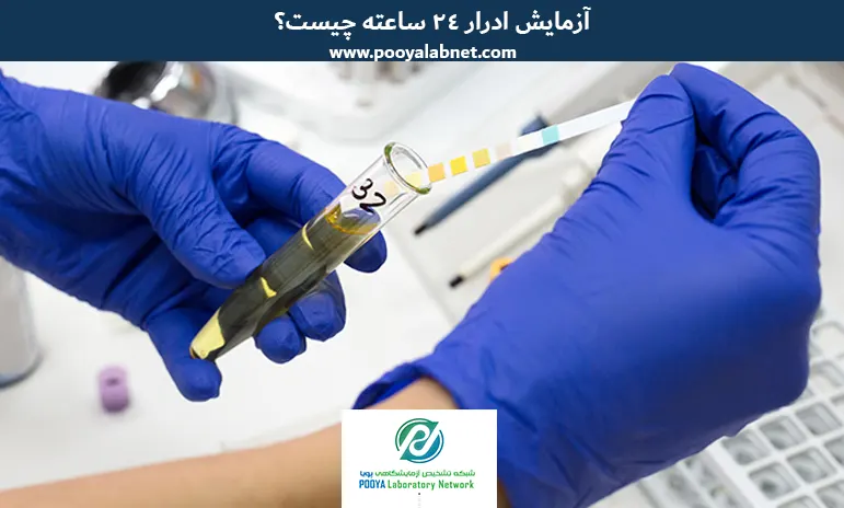 آزمایش-ادرار-24-ساعته