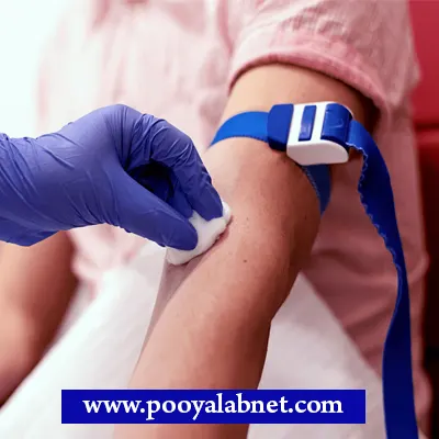 شرایط آزمایش ferritin