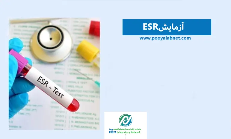 آزمایش ESR