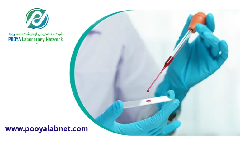 شرایط آزمایش cbc