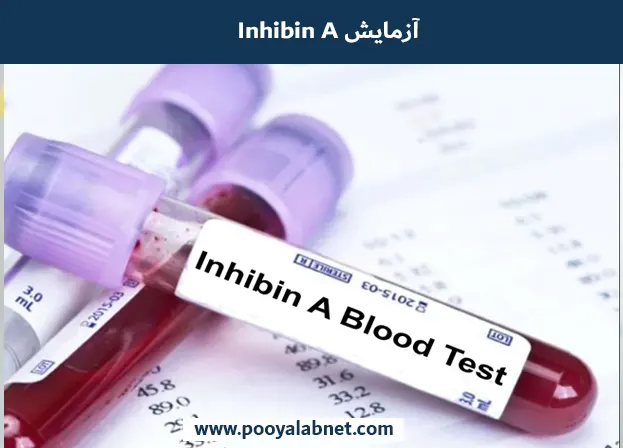 Inhibin A آزمایش