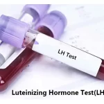 شرایط آزمایش LH